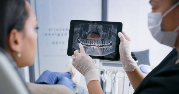 Licensed Tooth Extraction service in Lafayette Parish County, LA - Smile Center Dentistry